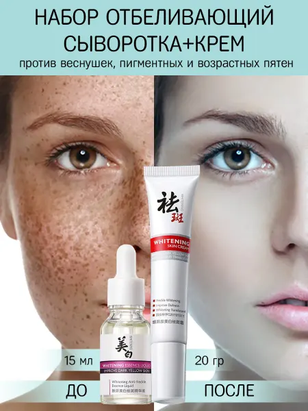 Отбеливающий набор крем с сыворотка для лица от пигментных