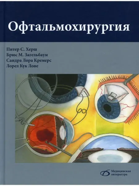 Медицинская литература Офтальмохирургия