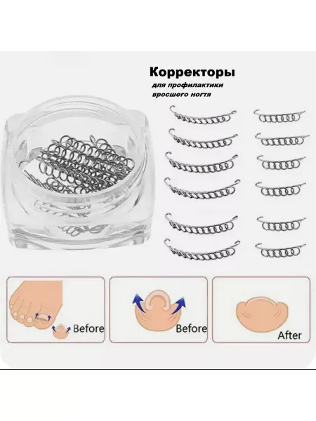 New AC Фиксатор вросшего ногтя