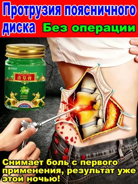 Мазь от грыжи позвоночника, 30 г