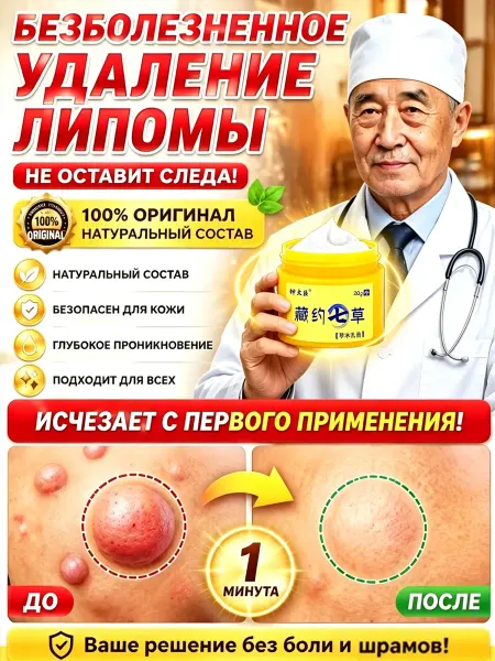 乔记本草 Мазь для удаления липомы30 г