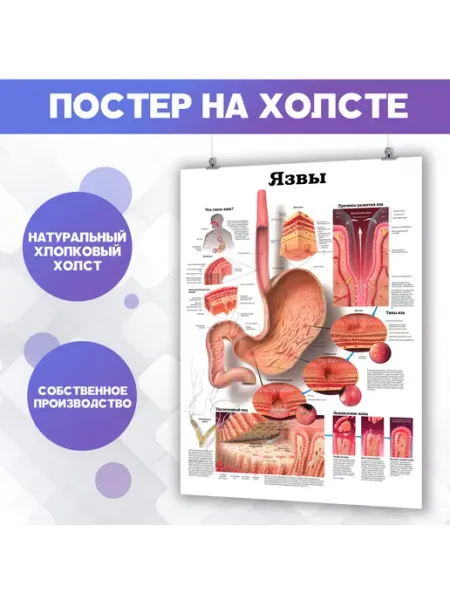 POSTERNAK Постер в больницу гастроэнтеролог, анатомия (2) 30х40 см