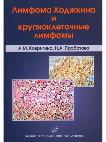 Медицинское информационное агентство Лимфома Ходжкина и крупноклеточные лимфомы