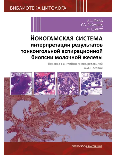 Практическая медицина Йокогамская система интерпретации биопсии молочной железы