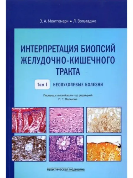 Практическая медицина Интерпретация биопсий пищеварительного тракта