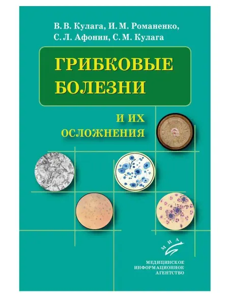 МИА Грибковые болезни и их осложнения