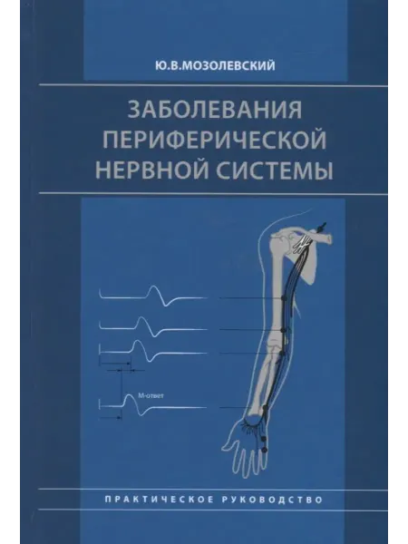 МедПресс-Информ Заболевания периферической нервной системы