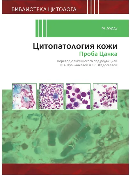 Практическая медицина Цитопатология кожи. Проба Цанка