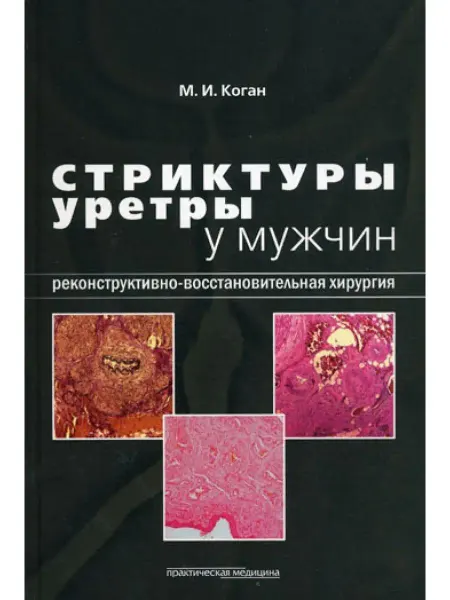 Практическая медицина Стриктуры уретры у мужчин