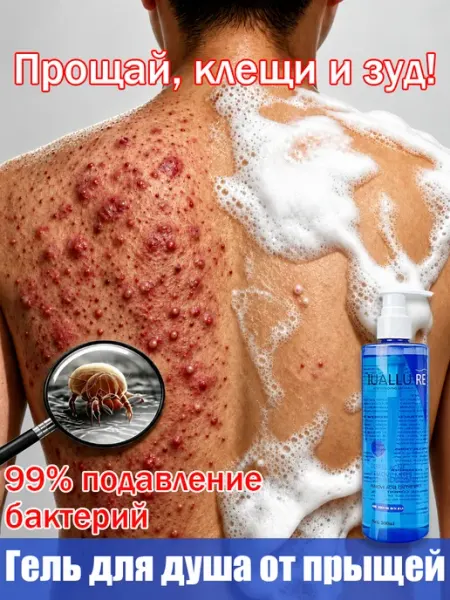 Гель для душа с салициловой кислотой ниацинамидом от клещей