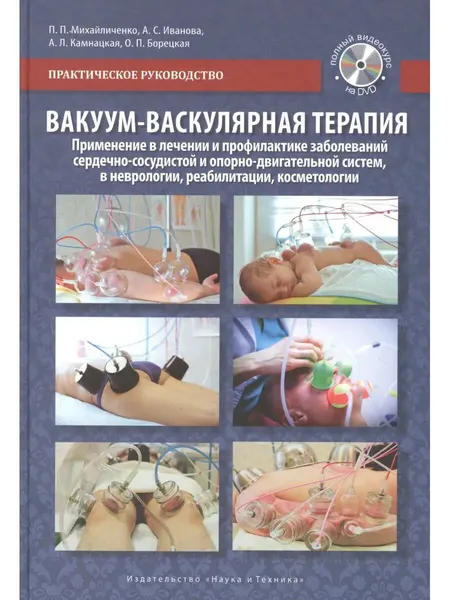 Вакуум-васкулярная терапия. Применение в лечении и профилакт