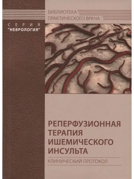 Реперфузионная терапия ишемического инсульта. Клинический пр