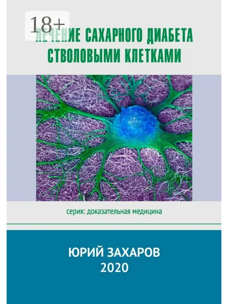 Лечение сахарного диабета стволовыми клетками