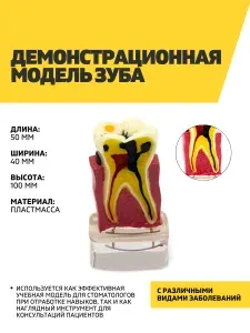 Демонстрационная модель зуба с различными видами заболеваний