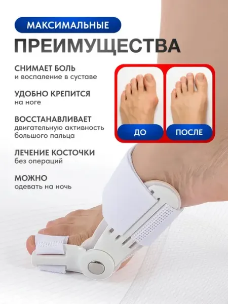 Вальгусная шина, корректор большого пальца Нет бренда