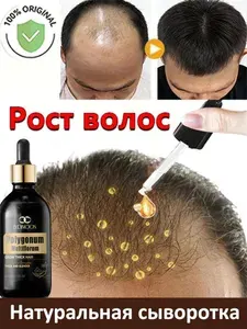 Сыворотка для волос,Используется для активизации роста волос,увеличения густоты, предотвращает выпадение и облысение, для женщин и, мужчин 50 мл