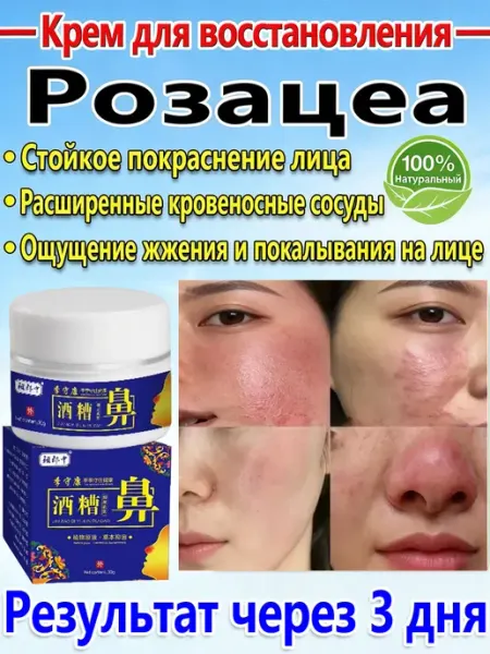 Крем для лица увлажняющий от купероза и розацеа