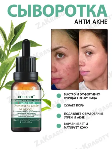 Сыворотка от прыщей, акне и постакне ZaKrasoty