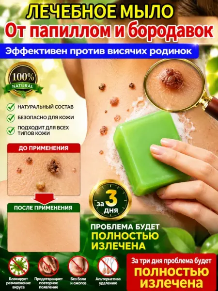 Мыло для лечения подошвенных бородавок чудо мыло