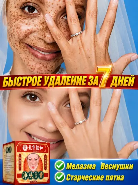 Крем для лица от пигментации и пятен, 30 г