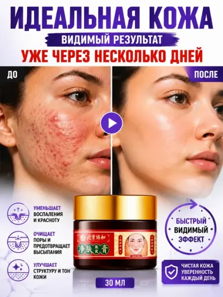 Likato крем для лица от прыщей