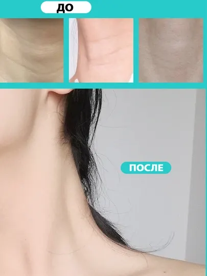 Невидимые патчи - тейпы для шеи против морщин, омолаживающие 5 штук - Косметологические тейпы и бандажи