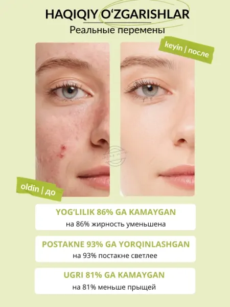 Ниацинамид и цинковое масло контрольная сыворотка Mixit Anti-Blemish, 30 мл - Средства для ухода за лицом