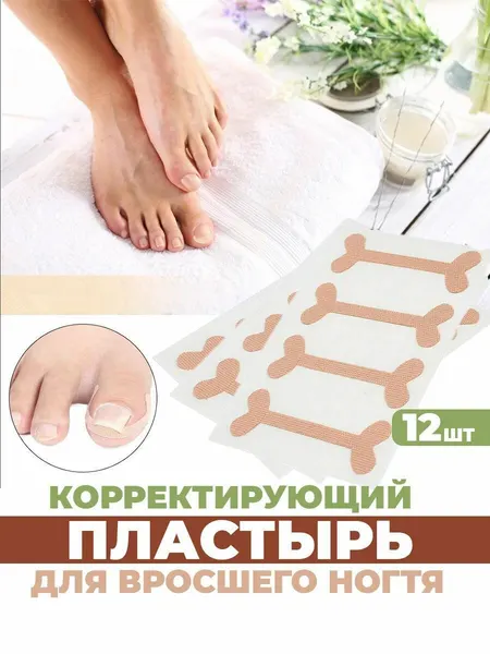 От вросшего ногтя пластырь корректор, от врастания на пальце