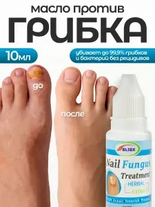 Масло для ногтей от грибка, средство для лечения грибка Nail Fungus, 10 мл., лечение онихолизиса