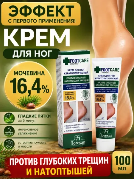 Крем для ног с мочевиной от трещин и натоптышей, 100 мл Floresan