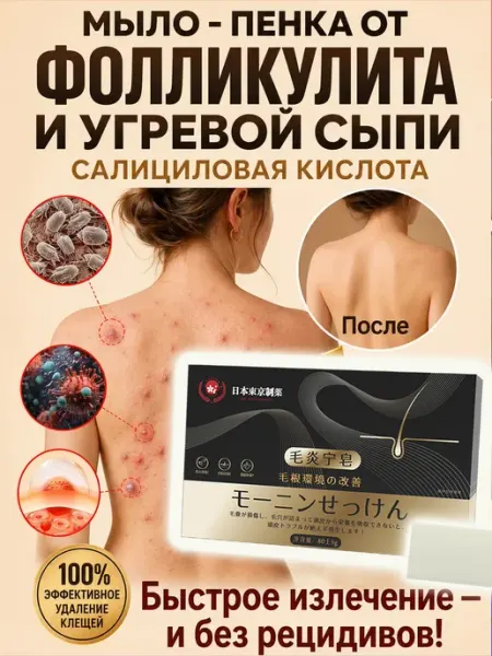 Мыло банное от прыщей себорейный и фолликулит лице и спине