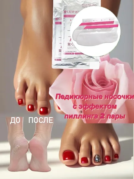 Педикюрные носочки с эффектом пилинга Sosu " Роза" 2 пары, от трещин и натоптышей. Универсальный размер .