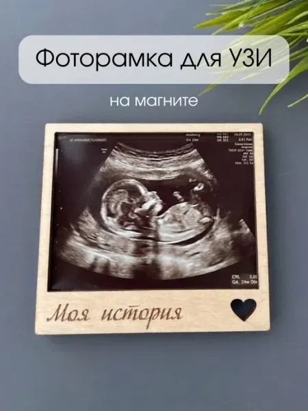 Lazer_bobr Фоторамка для узи "Моя история"
