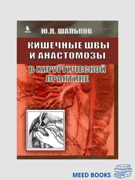 Кишечные швы и анастомозы в хирургической практике, Шальков Юлий Леонидович