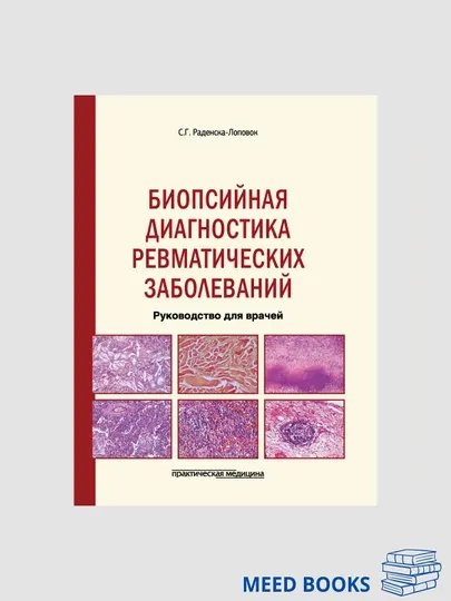 Биопсийная диагностика ревматических заболеваний | Медицинская литература