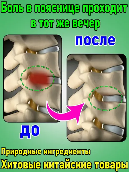 Пластырь при грыже поясничного диска и болях в спине, 5 шт