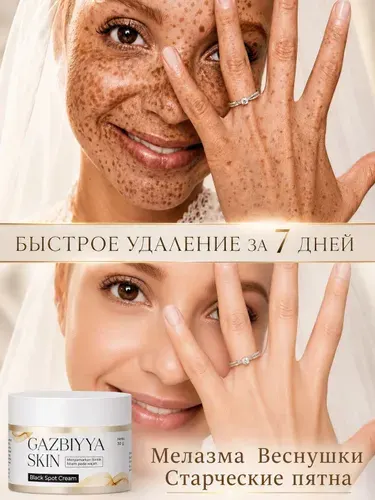 Крем для отбеливания и удаления веснушек/ для удаления веснушек , пигментных пятен , мелазмы, для ровного тона кожи, 30 мл