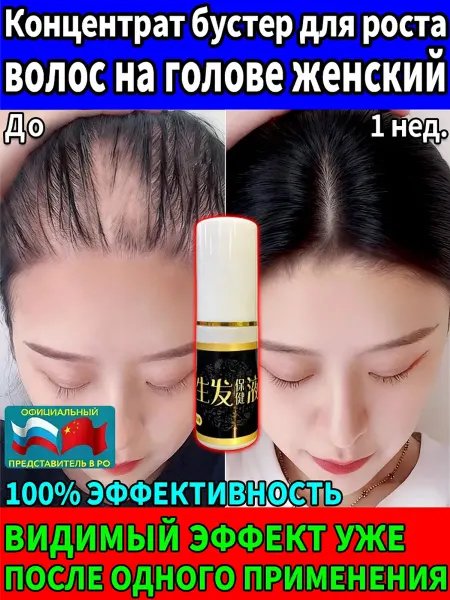 Спрей Чудо Китая Натуральная сыворотка для роста волос и от выпадения