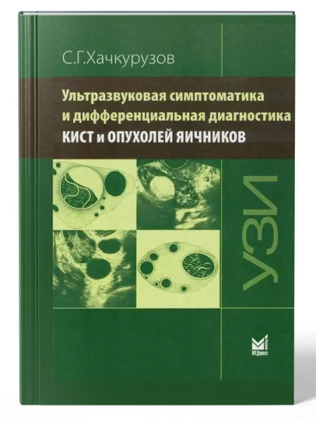 Ультразвуковая симптоматика и дифференциальная диагностика Кист и Опухолей яичников