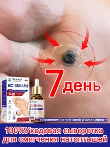 Уходовая сыворотка от мозолей и натоптышей. Смягчает и увлажняет огрубевшую кожу, облегчает удаление мозолей и поддерживает здоровье стоп, предотвращая образование новых