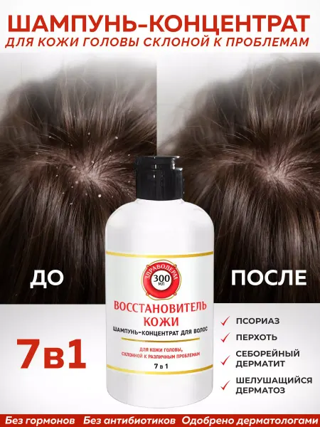 Zdravoderm Шампунь от перхоти, лечебный против псориаза, себореи и зуда