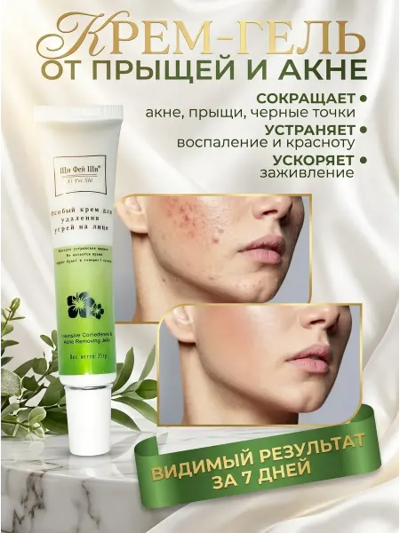 Крем для удаления угрей и акне