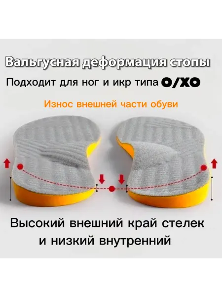 Моя Вещь Стельки ортопедические для коррекции вальгуса