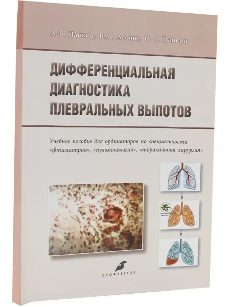 Эко-Вектор Дифференциальная диагностика плевральных выпотов