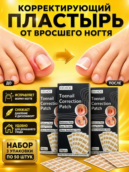 КСА11 Средство от вросших ногтей на ногах, пластырь корректирующий