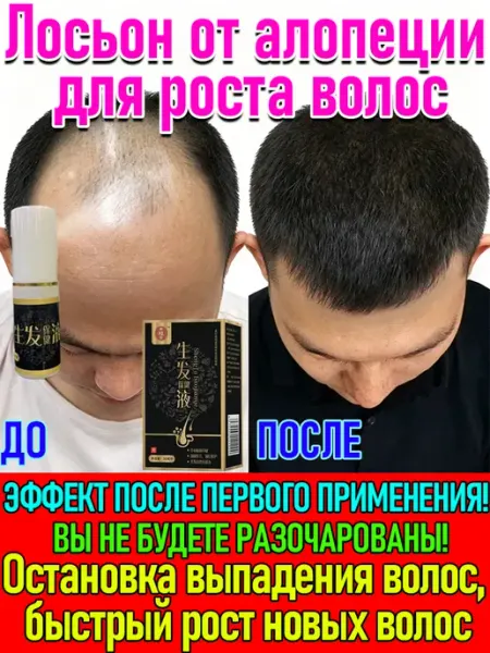 Лосьон-тоник для роста и восстановления волос