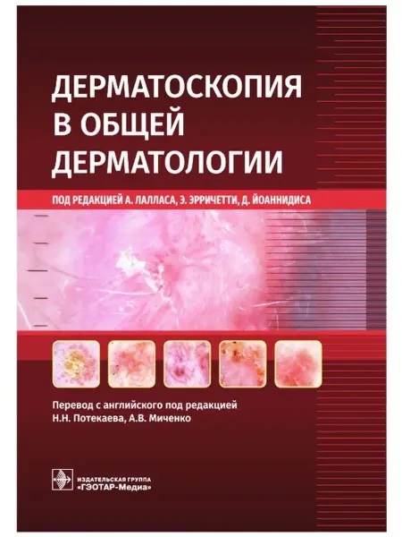 ГЭОТАР-Медиа Дерматоскопия в общей дерматологии под ред. Эрричетти и др