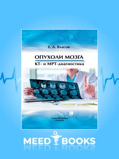 Опухоли Мозга Кт- и МРТ-Диагностика