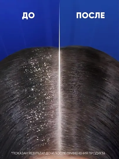 Head&Shoulders шампунь от перхоти и бальзам для волос Основной уход, 2 в 1, 1 л