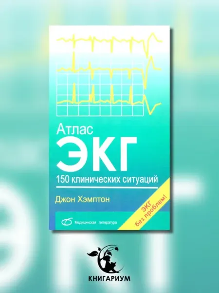 Медицинская литература Атлас ЭКГ 150 клинических ситуаций